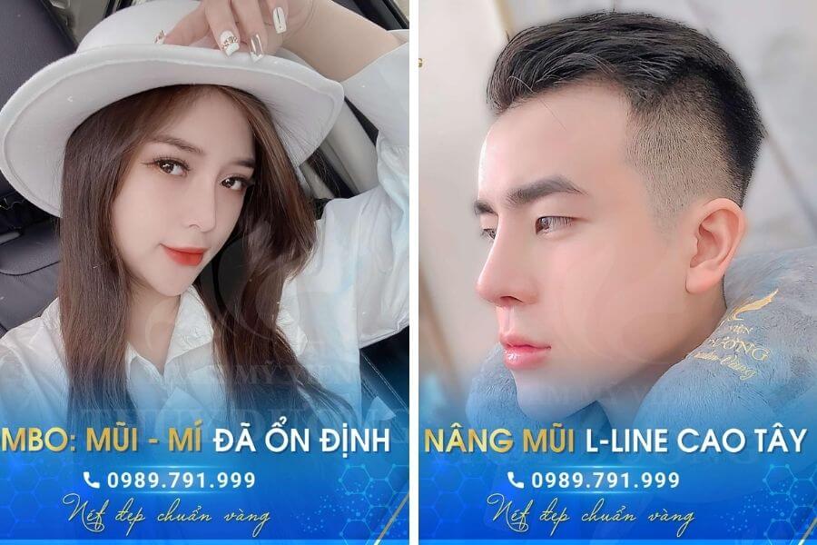 6 dáng mũi đẹp
