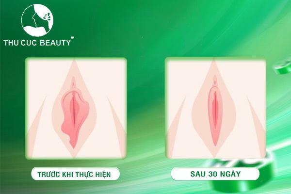 quá trình hồi phục môi bé