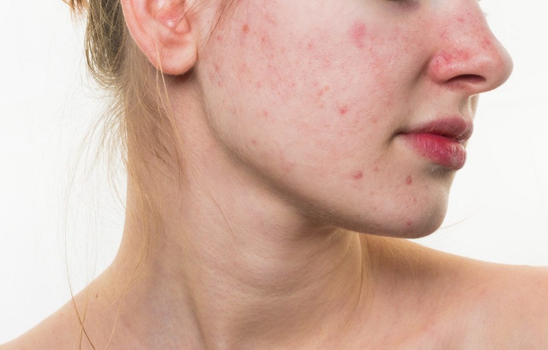 nguyen-tac-cham-soc-da-mat-mun